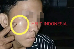 Mengaku Tak Memukul, Tapi Panti Qoroba Damai di Kantor Polisi