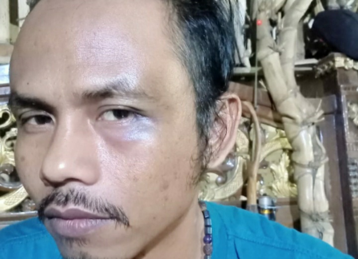 Polsek Kemiling Usahakan Damai Kasus Ketua RT Bogem Tukang Mebel