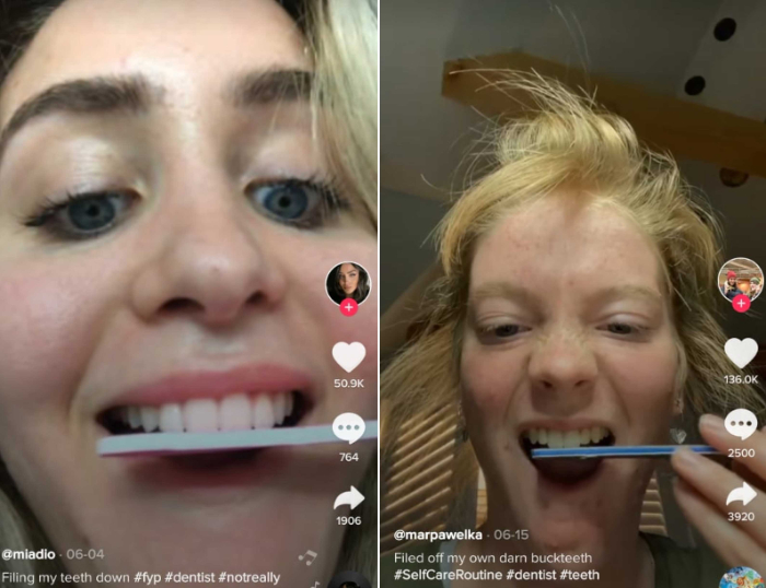 Mau Ikutan Perawatan Gigi DIY Ala TikTok? Perhatikan Hal-hal Penting Berikut Ini Dulu Yah