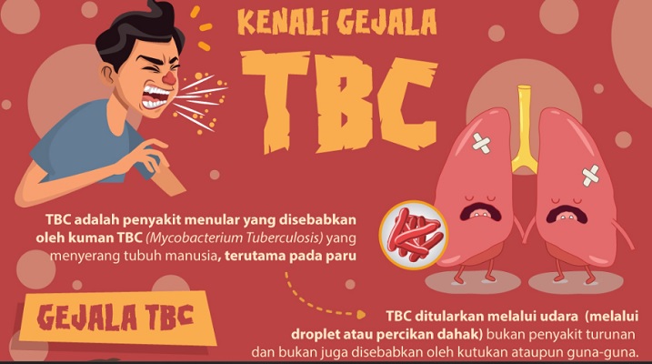 TBC Tubercolusis