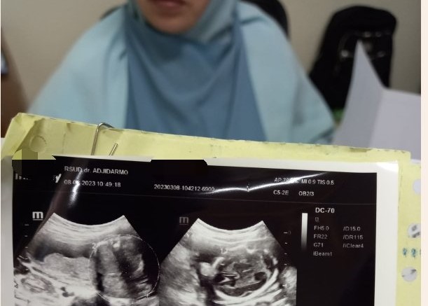 Banten Defisit Moral, Mandor Cabuli Kakak Beradik di Bawah Umur, Sang Kakak Cinta, Adiknya yang Hamil