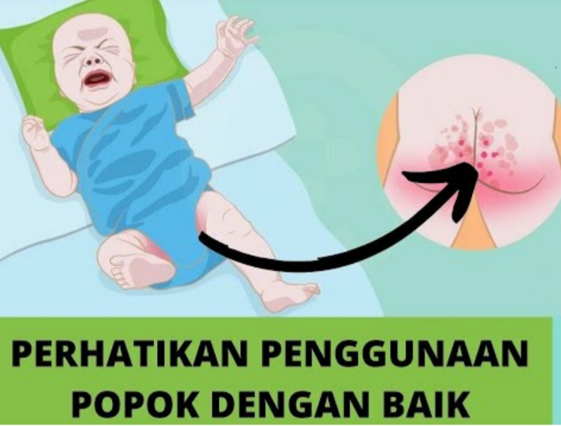 Waspada, Meski Tetap Kering, Ini Bahaya Terlalu Lama Tidak Mengganti Pampers Buah Hati Anda