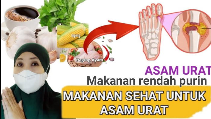 Jangan Termakan Mitos, Berikut Makanan dan Minuman yang Baik dan Buruk untuk Penderita Asam Urat