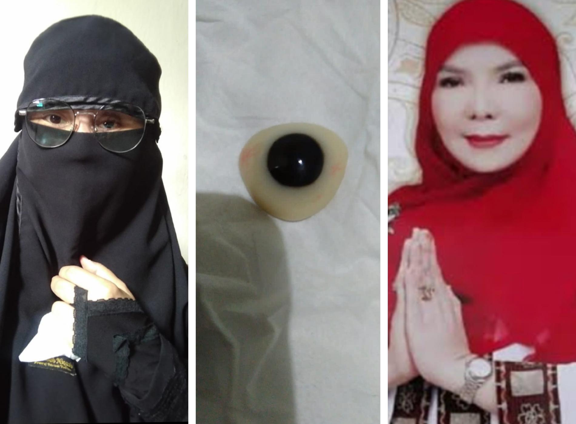 Korban ODGJ Terima Kasih pada Wali Kota dan Helo Sudah Pakai Mata Palsu