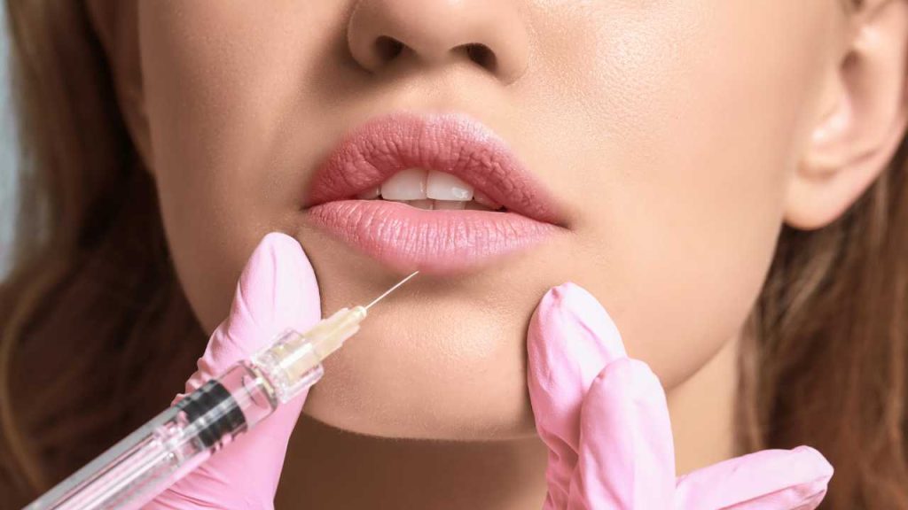 Hal Penting Ini Harus Diperhatikan sebelum Filler Bibir 