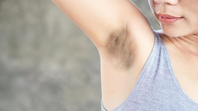 Ngeluh Ketiak Hitam dan Kasar, Begini Cara Mengatasinya