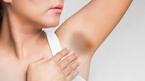 5 Rekomendasi Cream yang Ampuh Hilangkan Ketiak Hitam