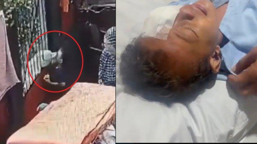 Viral! Video Tragis Bocah Digigit Anjing Tetangga Hingga Syaraf Air Matanya Putus
