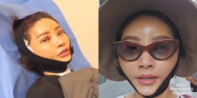 Pamer Wajah Pasca Operasi Plastik, Netizen: Kok Jadi Mirip Inul Daratista