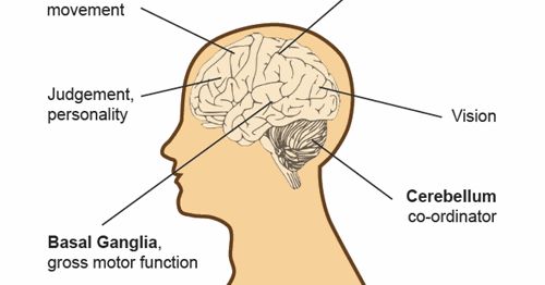 Mengenal Apakah Itu Cerebral Palsy yang Viral di Tiktok