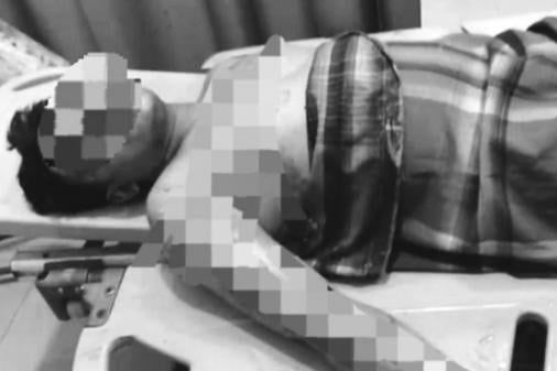 Viral ! Sakit Hati Karena Sering Diejek, Santri di Sumut Nekat Bakar Sang Guru Saat Tertidur