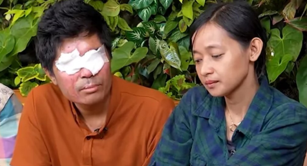 Buntut Donasi, Agus Korban Air Keras Laporkan Novi Pratiwi ke Polisi