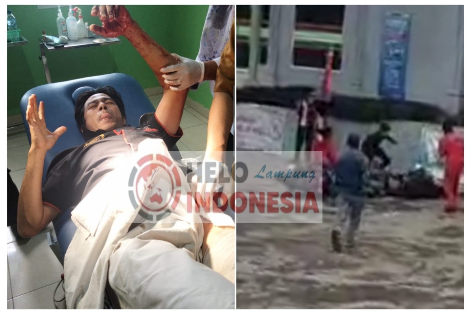 Perampok Tusuk dan Rampas Tas Petugas SPBU Negeri Sakti, Tataan