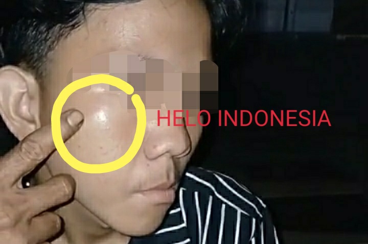 Mengaku Tak Memukul, Tapi Panti Qoroba Damai di Kantor Polisi