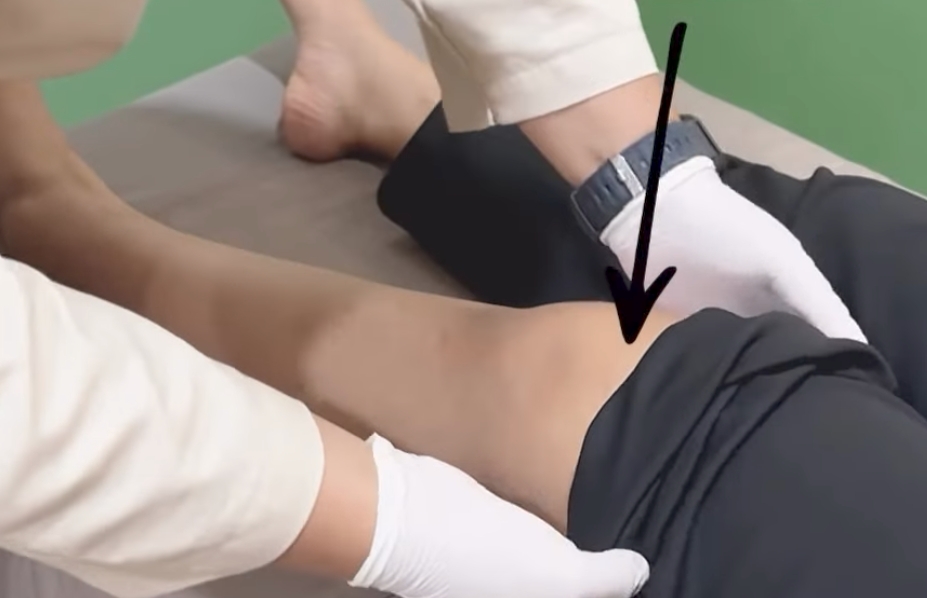 Tanda cidera kaki